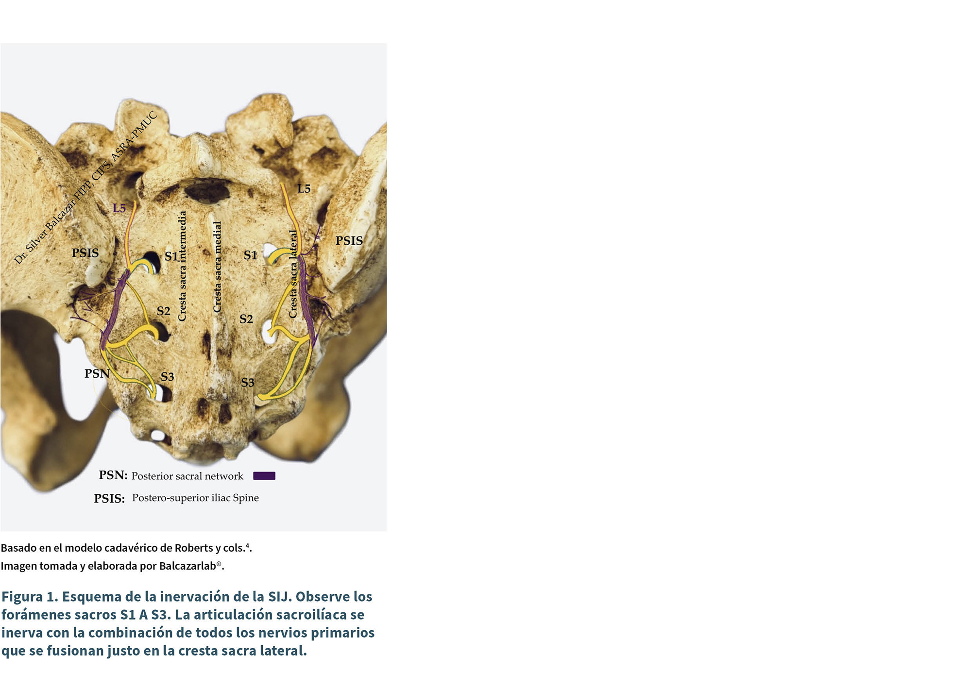 Esquema anatómico que muestra la inervación de la articulación sacroilíaca con los nervios primarios y los forámenes sacros en un modelo cadavérico.
Descripción generada con IA
